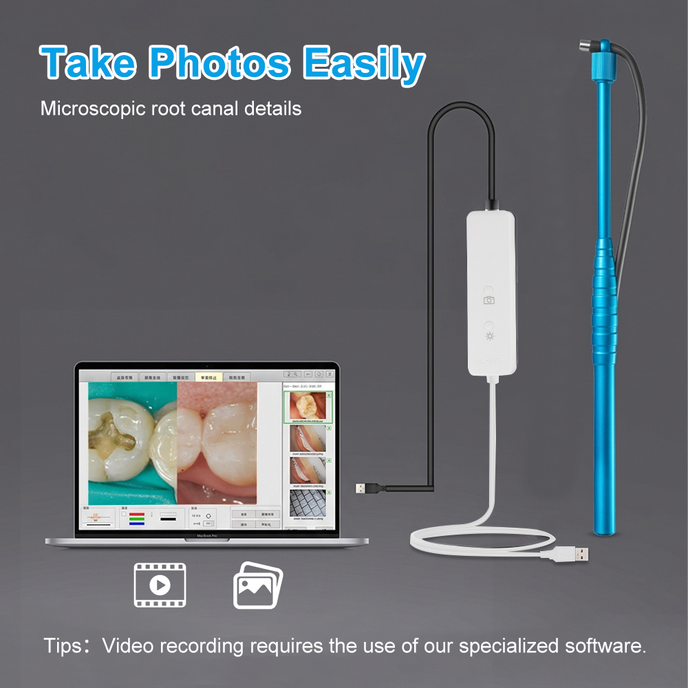 5MP Micro Intraoral Camera Den – Mini Pc Windows Bewertung und Preis